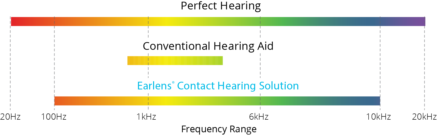 Earlens Hearing Aid